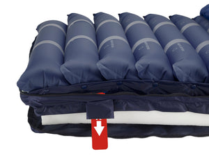 Med-Aire Assure Alternating Pressure and Low Air Loss Mattress System — view 4