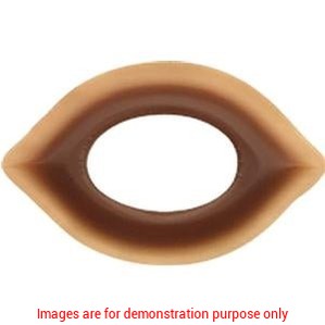 Adapt Ceraring Oval Convex, 7/8" X 1-1/2" (22Mm X 38Mm)Hollister