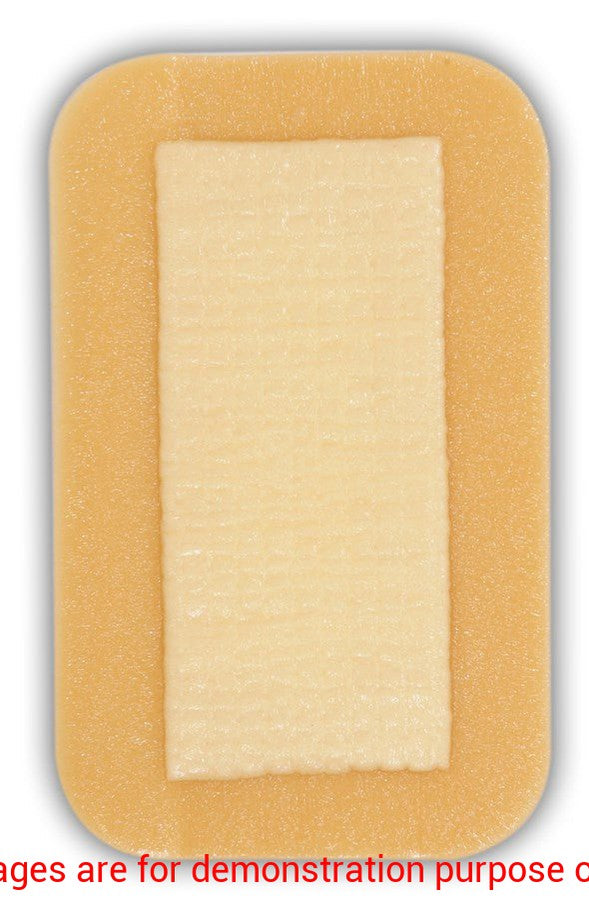 Aquacel Surgical Cover Dressing, Sterile 9Cm X 35CmConvatec