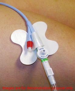 Cath-Secure Multi-Purpose Tube Holder 2 1/2In Wrap Tab, Butterfly BaseM.C. Johnson