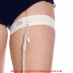 Conveen Catheter Retaining Strap, 90 CmColoplast