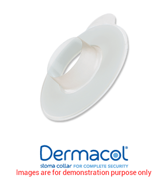 Dermacol Stoma Collar, Fits Stoma Size 33Mm - 35MmSalts Argyle Medical