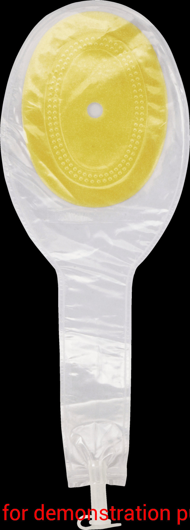 Eakin Fistula Wound Pouch W/ Tap Closure 4.3 X 3InConvatec