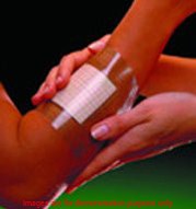 Opsite Flexifix Transparent Film Roll, Size 15Cm X 10MSmith & Nephew