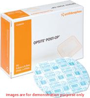 Opsite Post-Op Island Dressing, Size 15.5Cm X 8.5CmSmith & Nephew