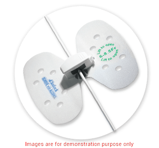 Statlock Universal Plus Stabilization Small 6-8.5Fr (Non-Returnable)Bard