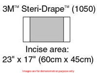 Steri-Drape Incise Drape, Sterile, Large 60 X 45Cm, Flexible Film Resistant To Tear, Conformable Wit3M