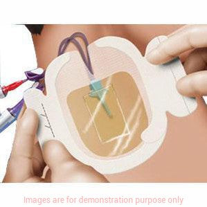 Tegaderm Chg Iv Securement Dressing3M
