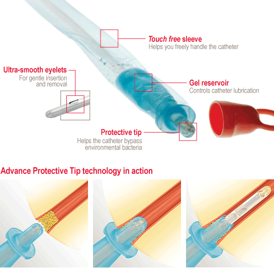 Touch Free Advance Ic Intermittent Coude Catheter W/ Intro Tip, Size 16Fr 16InHollister